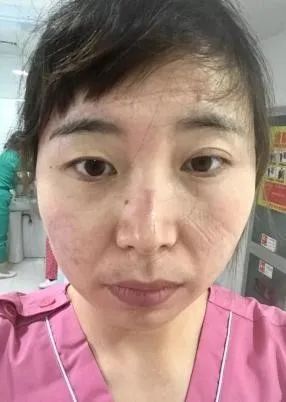 沈杭 安徽醫科大學第四附屬醫院EICU護士長